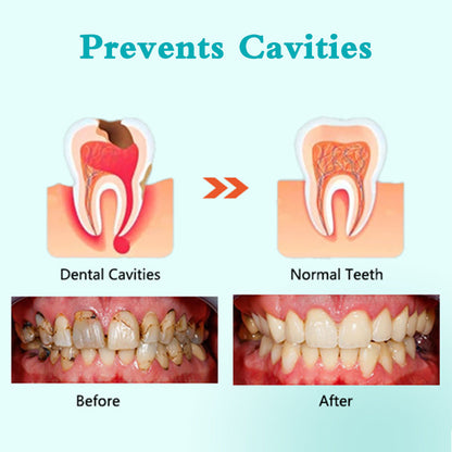 🦷🦷Teeth Whitening Coconut Oil Pulling with 7 Essential Oils and Vitamins. Remove Oral Issues