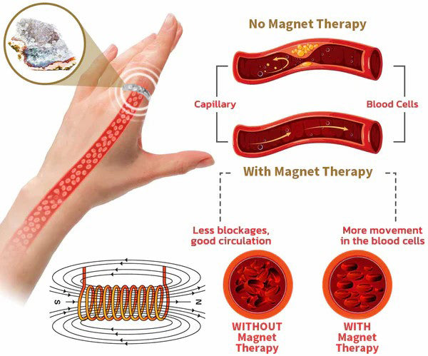 💖CZTICLE Lymphatic Magnetic Therapy Titanium Gypsophila Ring (🔥LAST DAY SALE-70% OFF)