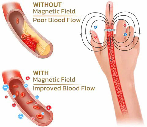 💖CZTICLE Lymphatic Magnetic Therapy Titanium Gypsophila Ring (🔥LAST DAY SALE-70% OFF)