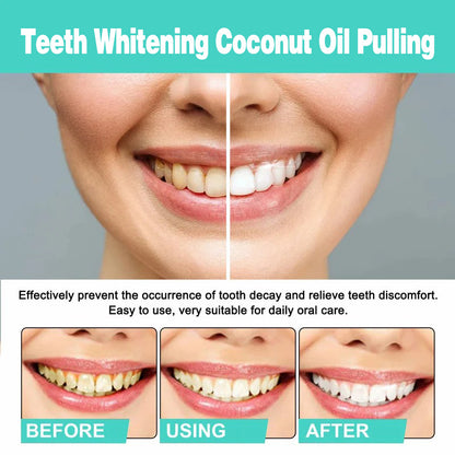 🦷🦷Teeth Whitening Coconut Oil Pulling with 7 Essential Oils and Vitamins. Remove Oral Issues